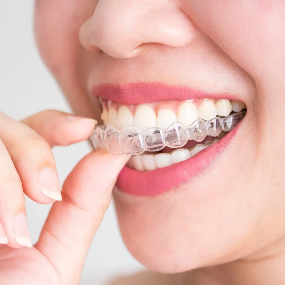1-4Pc Anti Snoring Bruxism Sle - Teeth Whitening Mouth Guard ulasan dan harga