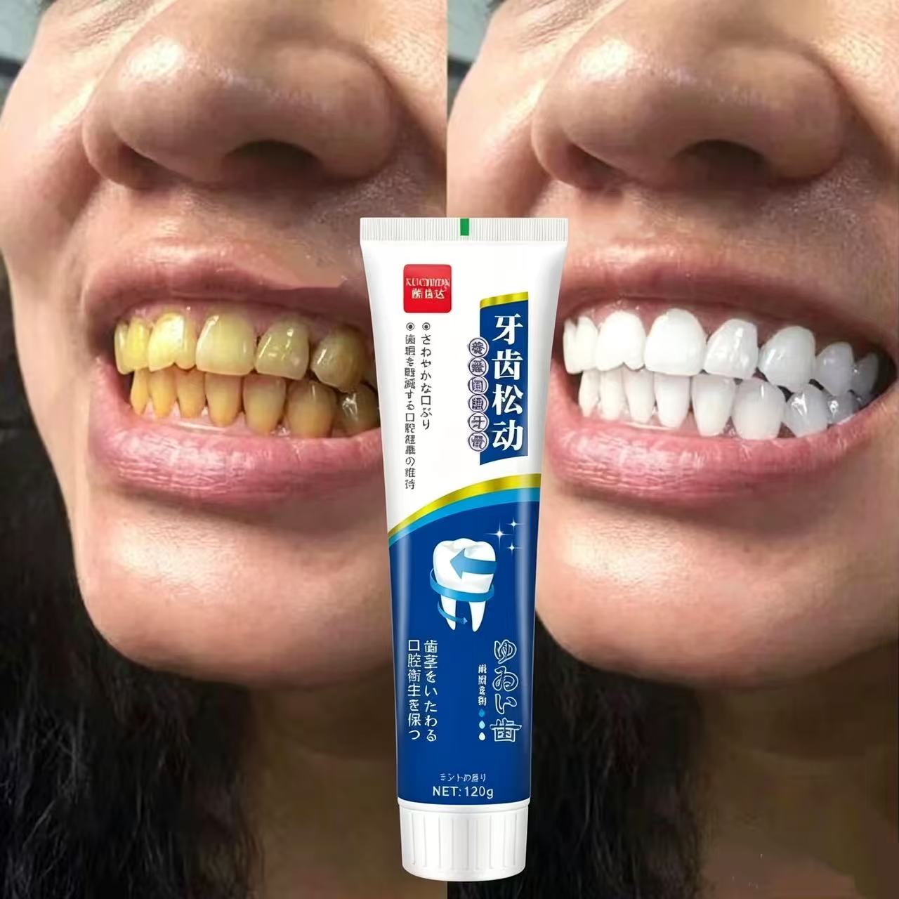 Fix Loose Teeth Japanese Impor - Teeth Whitening Japanese ulasan dan harga