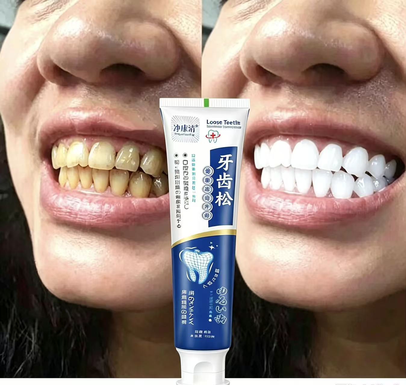 Fix Loose Teeth Japanese Impor - Teeth Whitening Japanese ulasan dan harga
