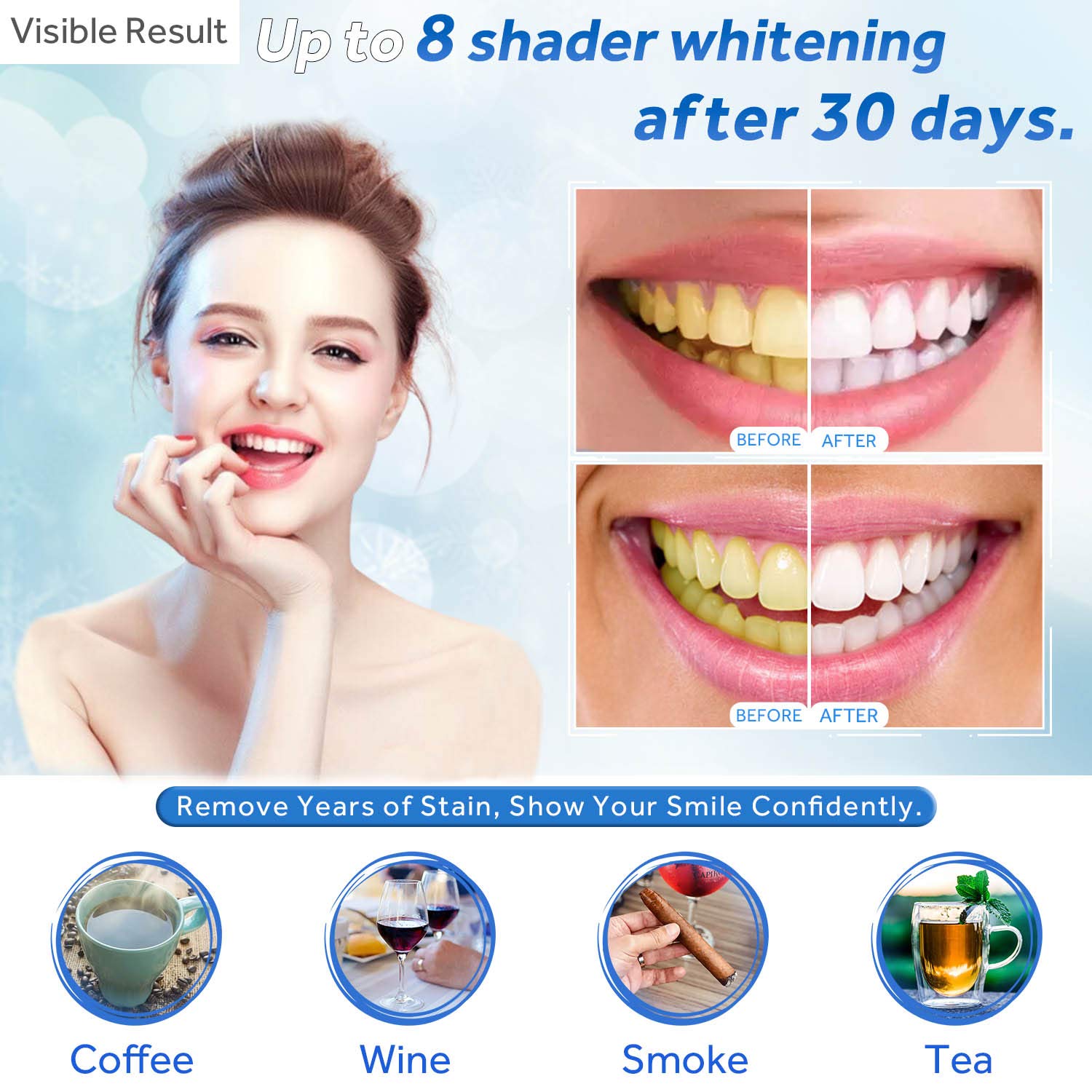 Teeth Whitening Gel Refill Syr - Teeth Whitening Mouth Guard ulasan dan harga
