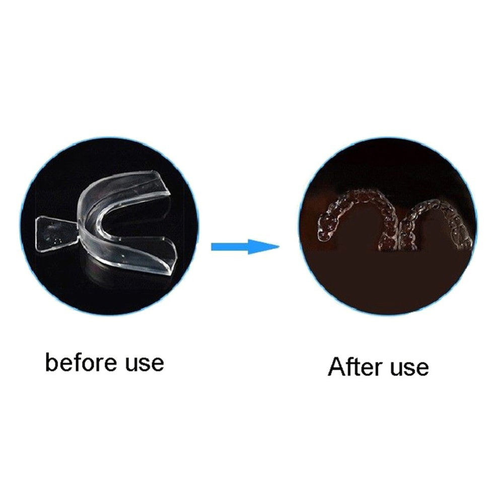 2/4pcs Soft Tooth Orthodontic  - Teeth Whitening Mouth Guard ulasan dan harga