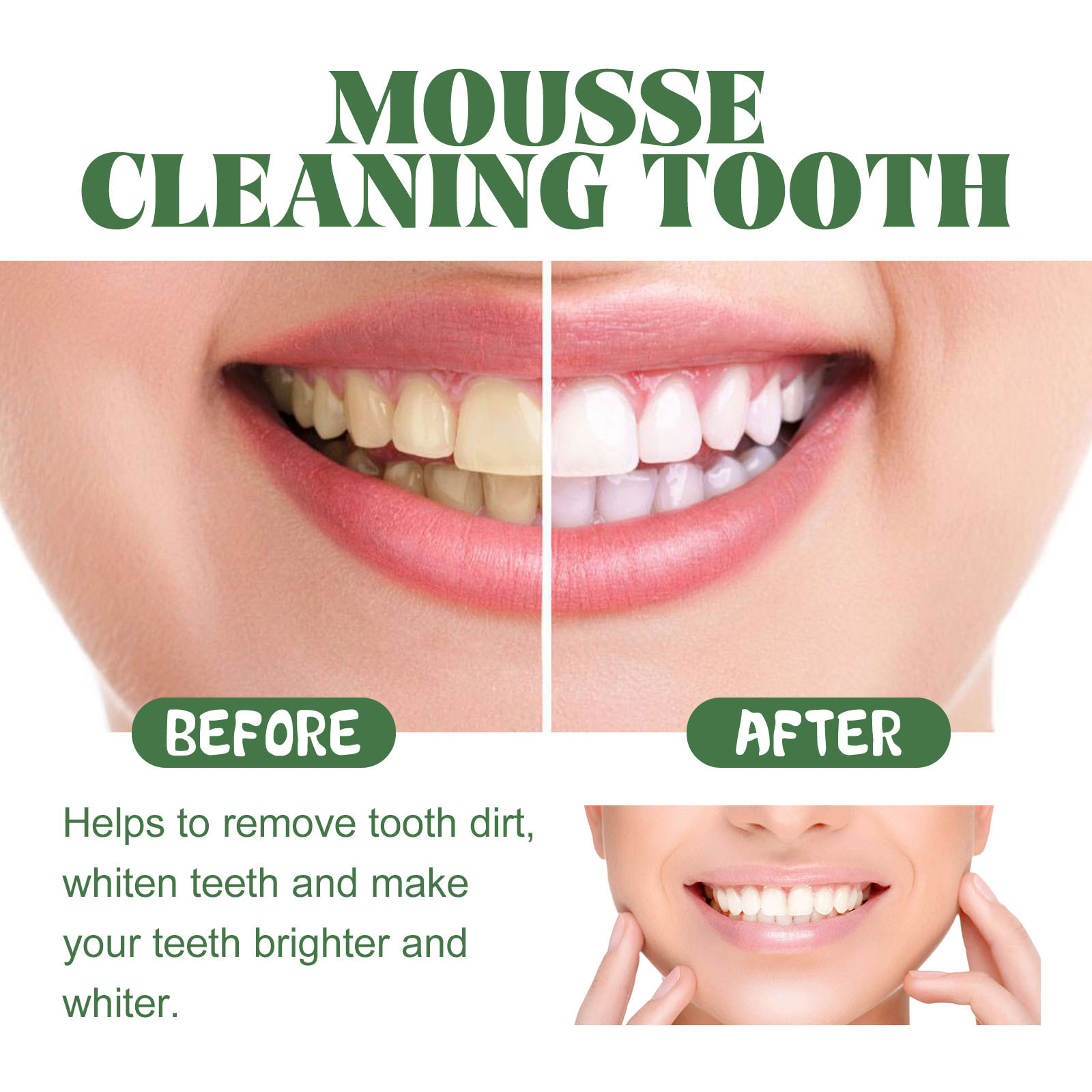 Portable Travel Size Whitening - Teeth Whitening Mousse ulasan dan harga