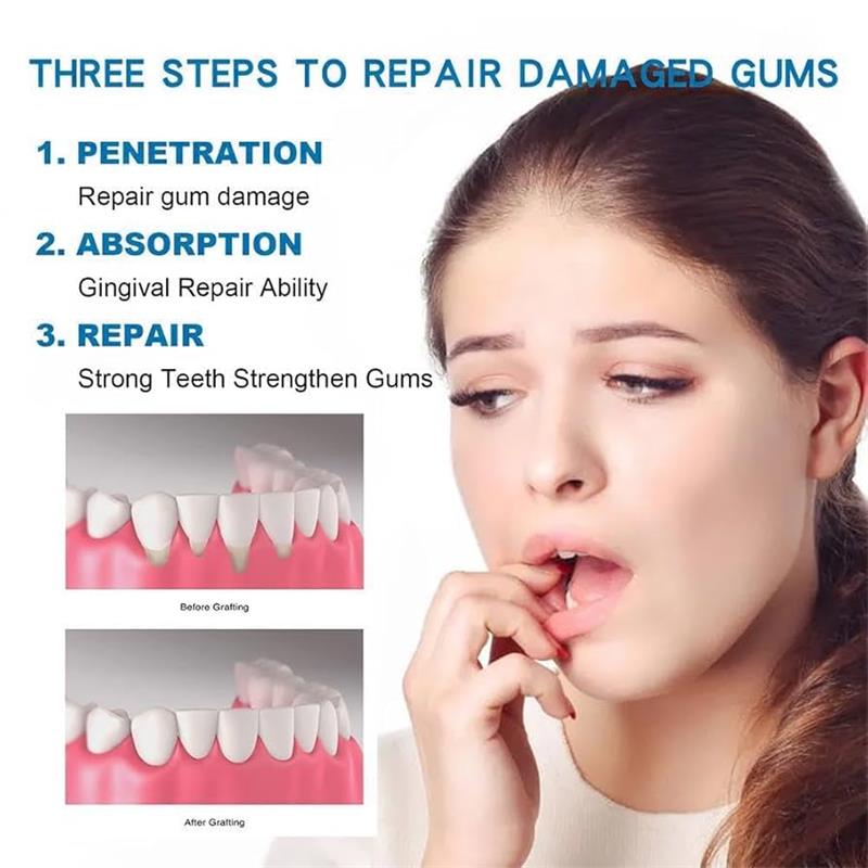 Gum Repair Care Serum Relieve  - Teeth Whitening Gingival Barrier ulasan dan harga