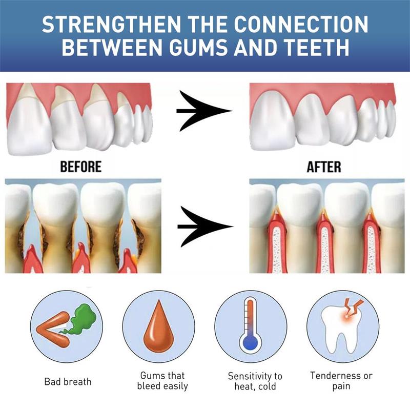 Gum Repair Care Serum Relieve  - Teeth Whitening Gingival Barrier ulasan dan harga
