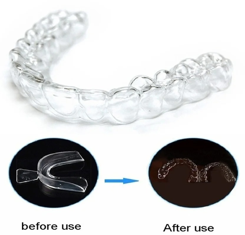 Anti Snoring Bruxism Sleeping  - Teeth Whitening Mouth Guard ulasan dan harga