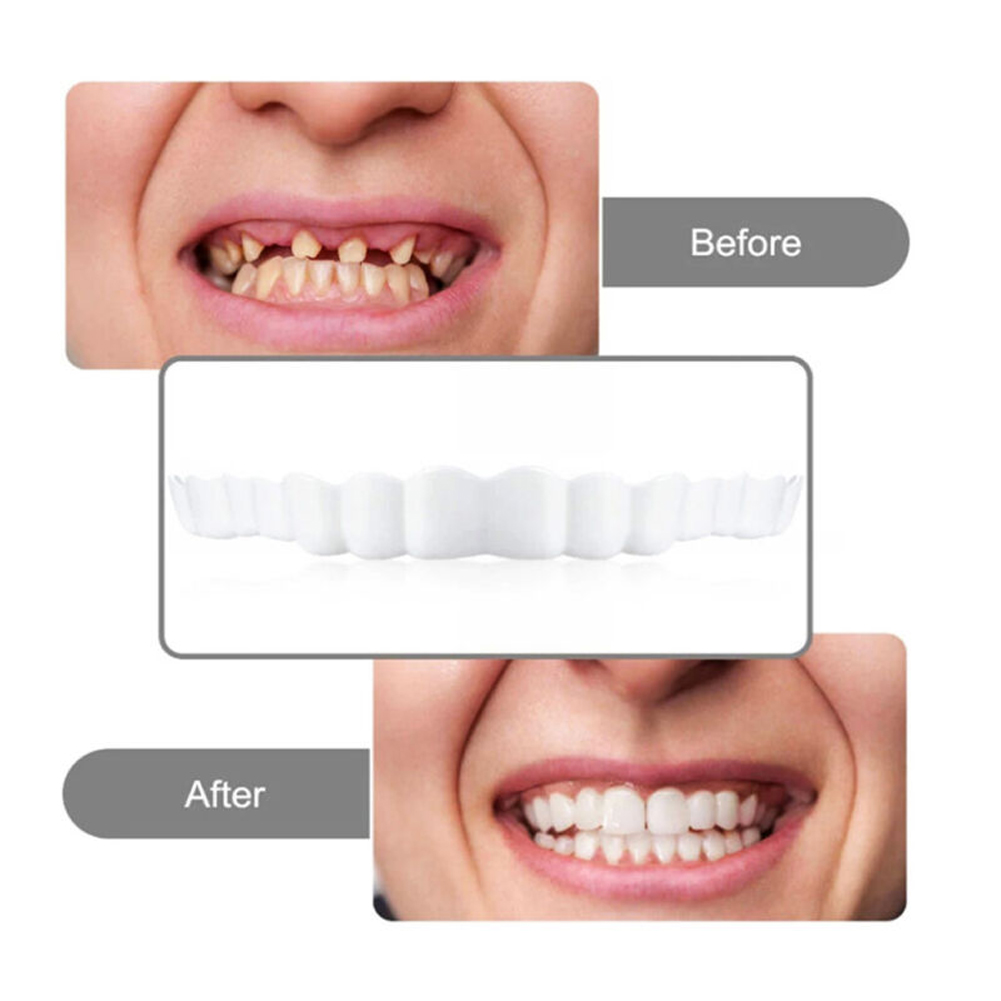 4-6 Pairs Upper&Lower Jaw Dent - Teeth Whitening Mouth Guard ulasan dan harga