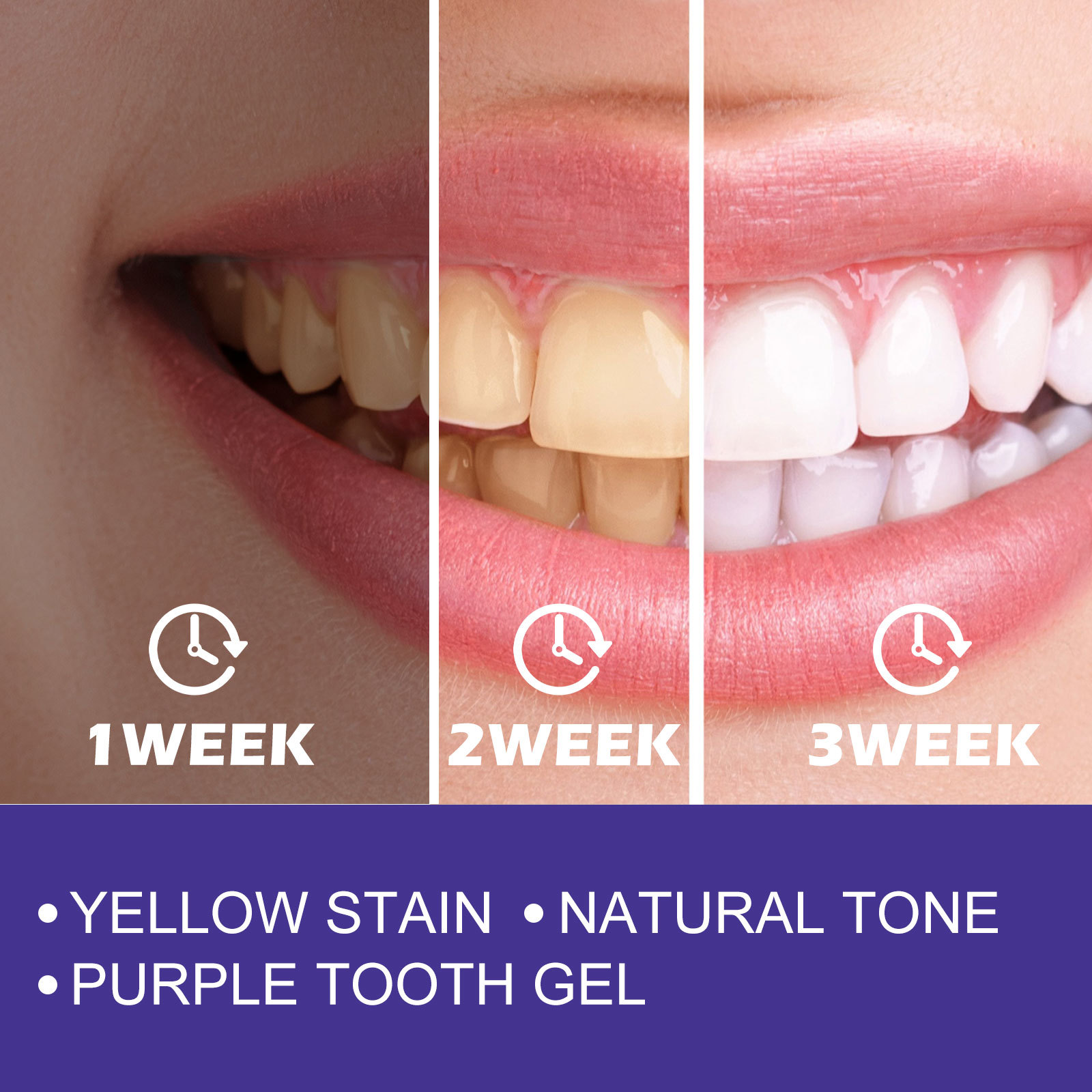 Purple Toothpaste Teeth Whiten - Teeth Whitening Crest ulasan dan harga