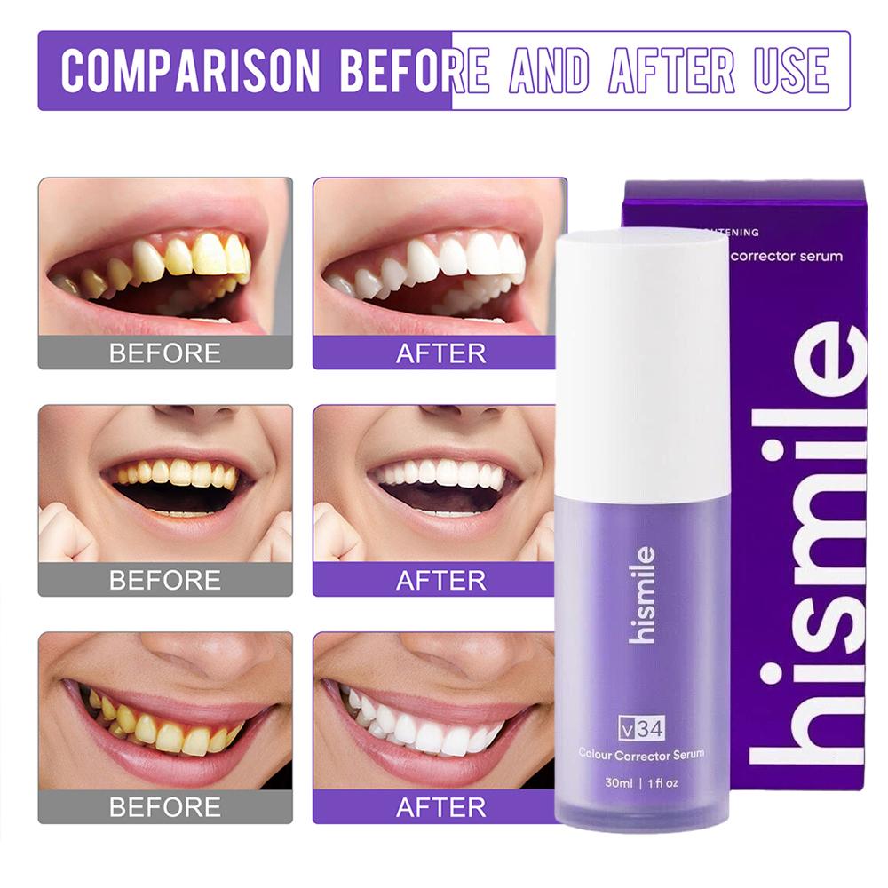  Purple V34 Hismile Teeth Bri - Teeth Whitening Crest ulasan dan harga