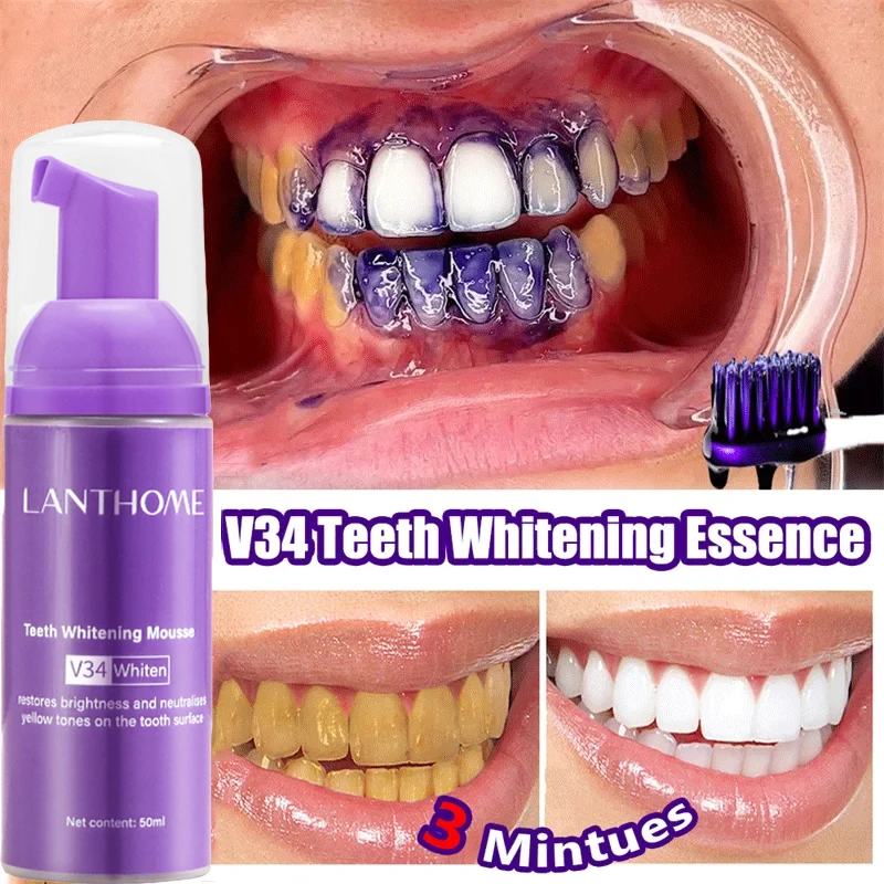 V34 Teeth Whitening Mousse Too - Teeth Whitening Mousse ulasan dan harga