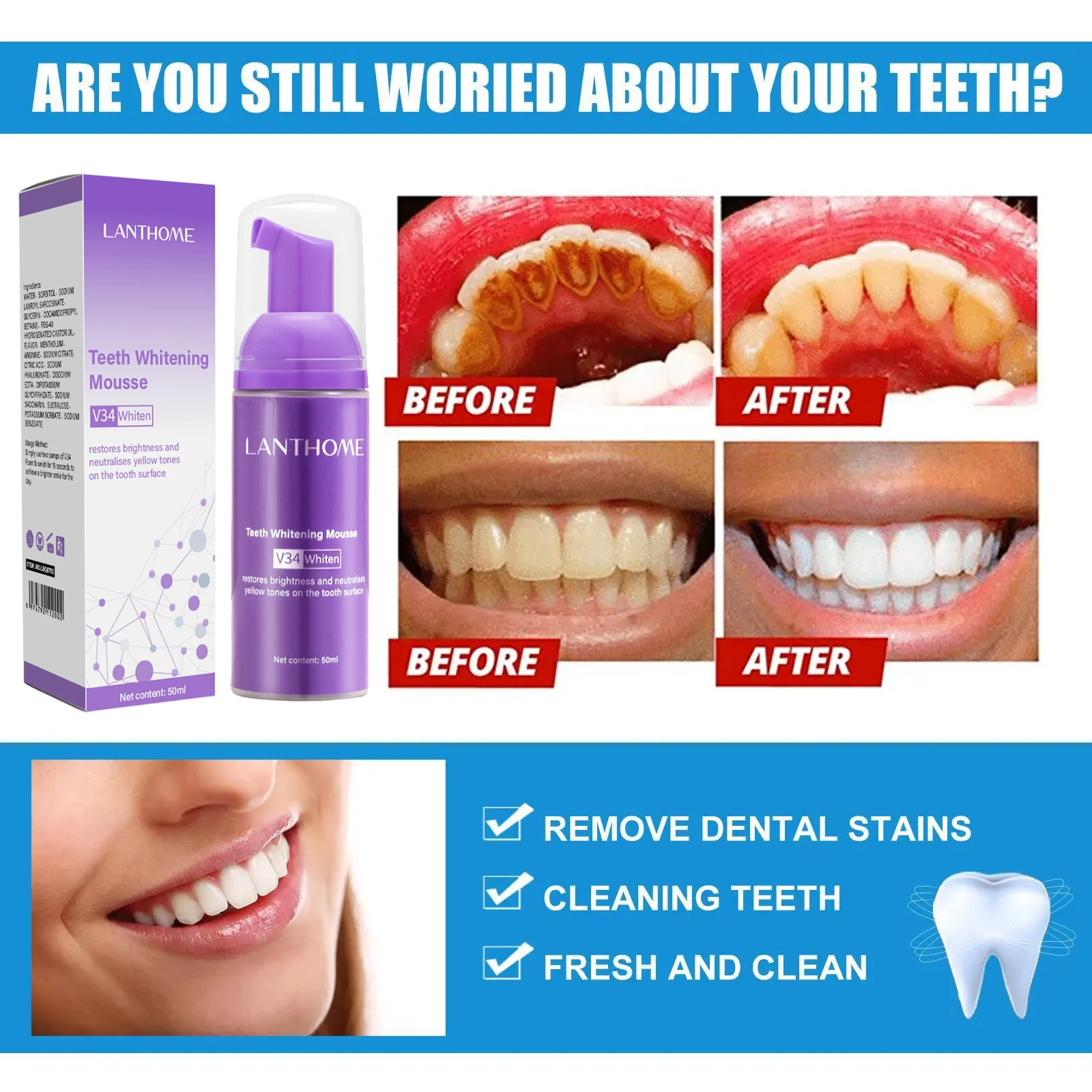 V34 Teeth Whitening Mousse Too - Teeth Whitening Mousse ulasan dan harga
