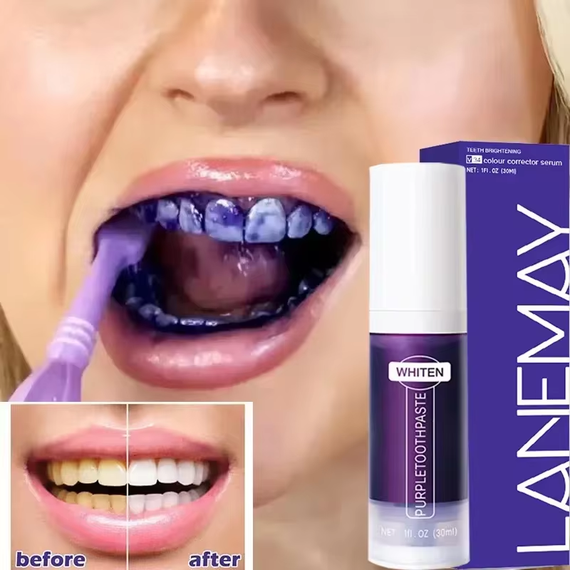 V34 Purple Teeth Whitening Too - Teeth Whitening Crest ulasan dan harga