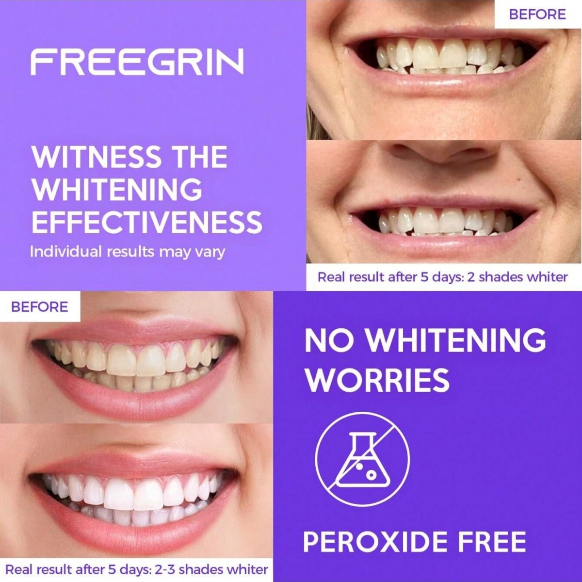 Deluxe Whitening Teeth Sticker - Teeth Whitening Gels Used By Dentists ulasan dan harga