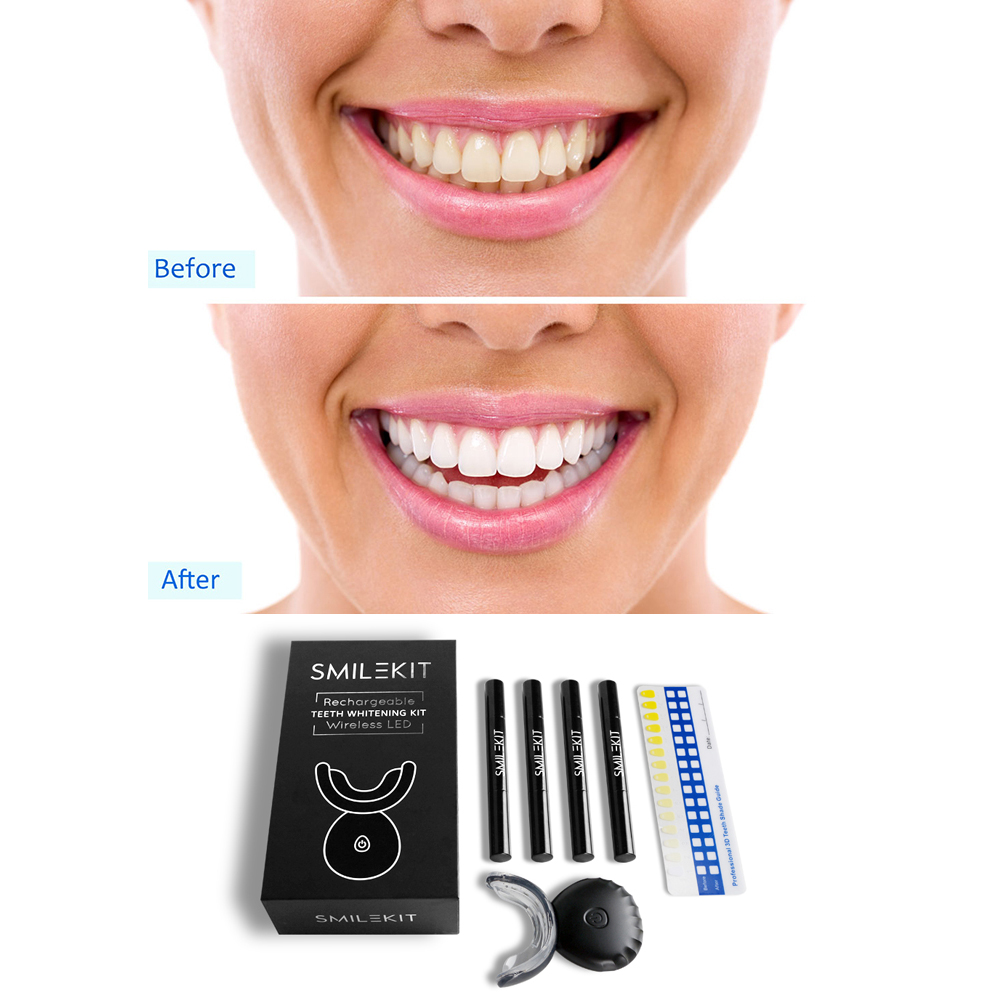 New Electric Teeth Whitening L - Teeth Whitening Home Kit ulasan dan harga