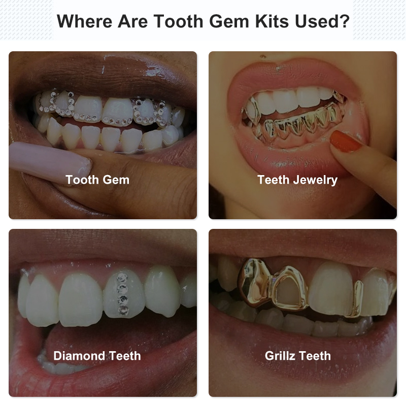 Tooth Gem Set Glue Kit with UV - Uv Whitening Kit ulasan dan harga
