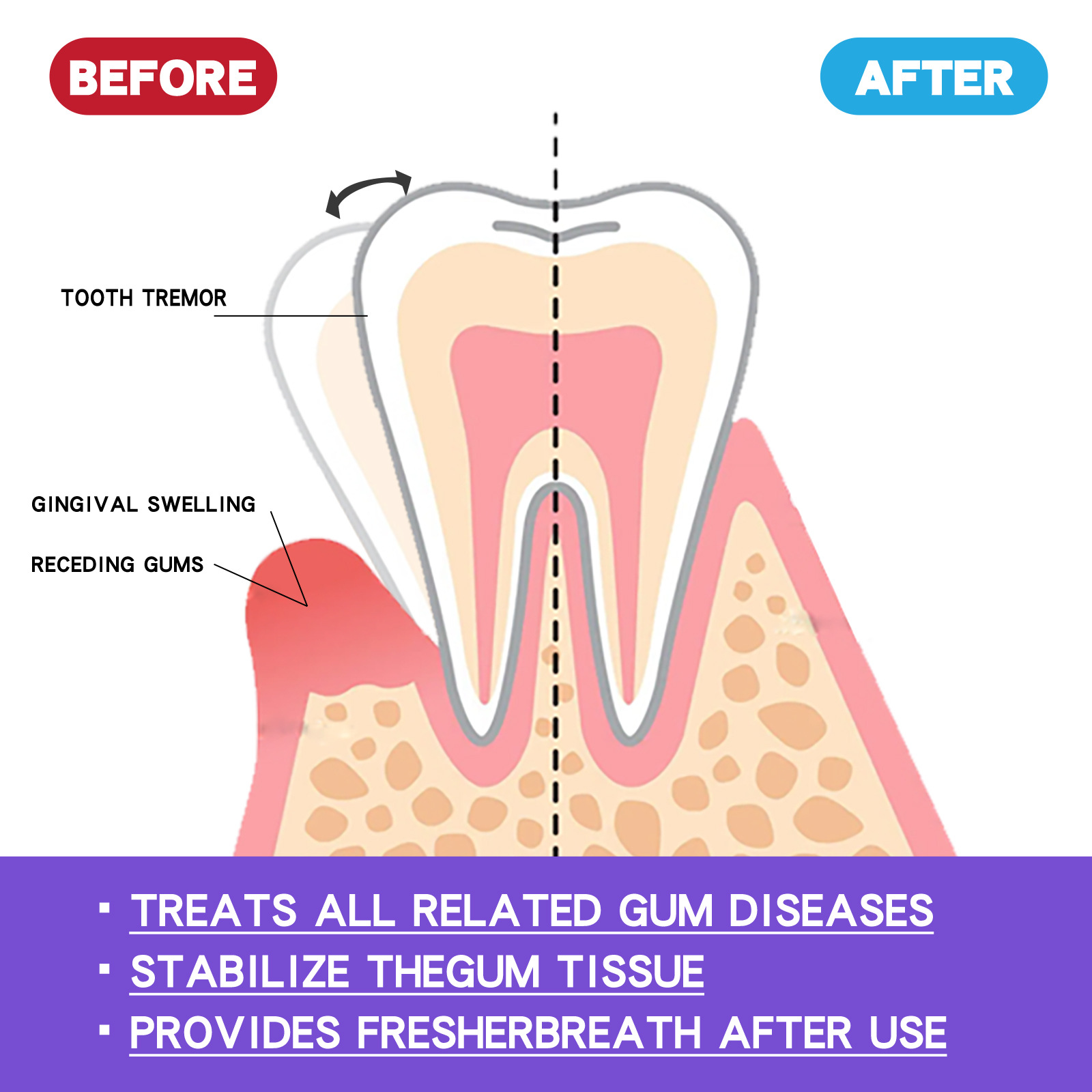 60ml Teeth Whitening Mousse V3 - Teeth Whitening Mousse ulasan dan harga