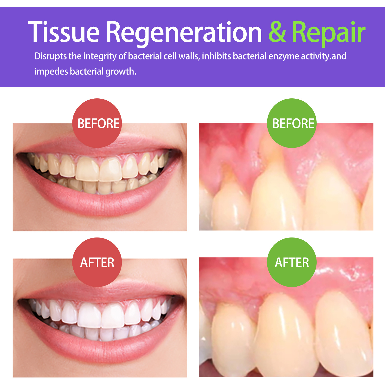 60ml Teeth Whitening Mousse V3 - Teeth Whitening Mousse ulasan dan harga