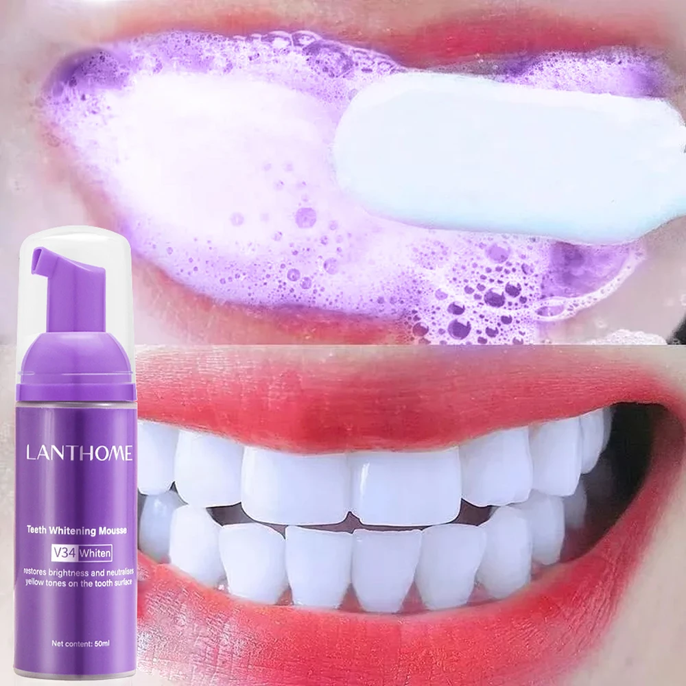 Mousse V34 Toothpaste Teeth Cl - Teeth Whitening Crest ulasan dan harga